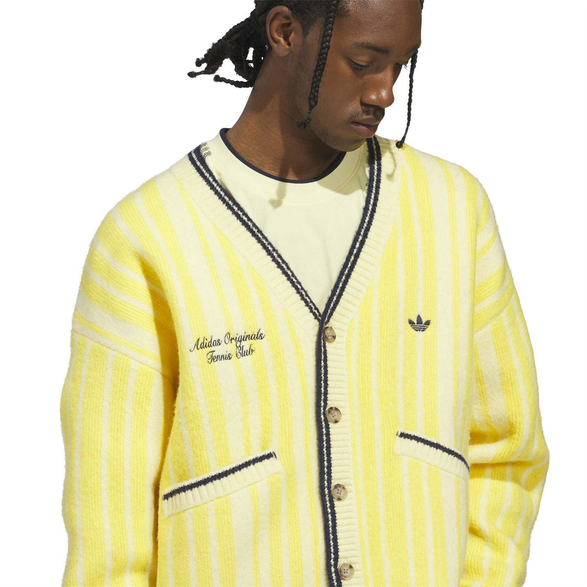 Yellow striped cardigan close-up with navy V-neck trim, button placket, and chest logo.
